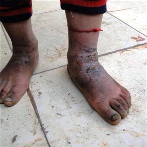 giá rét, băng tuyết, trẻ vùng cao, ‘trần truồng’, rét âm độ