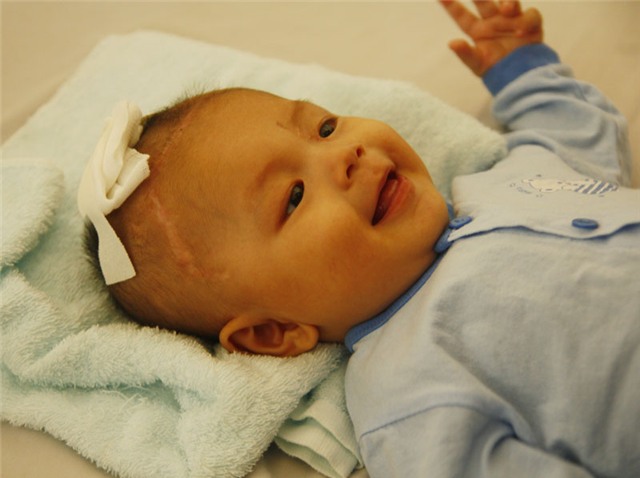 bé trai bị đâm xuyên sọ, hồi phục, xuất viện, đón Tết