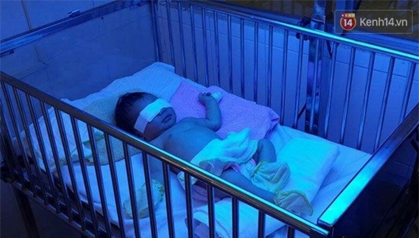 Đồng Nai: Mẹ cắn đứt ngón tay bé gái 2 ngày tuổi - Ảnh 1.