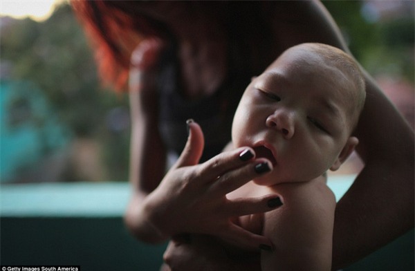 Chùm ảnh: Dịch bệnh Zika đầu nhỏ - nỗi khiếp sợ của toàn thế giới - Ảnh 1.