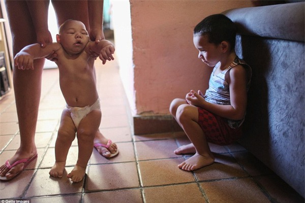 Chùm ảnh: Dịch bệnh Zika đầu nhỏ - nỗi khiếp sợ của toàn thế giới - Ảnh 2.