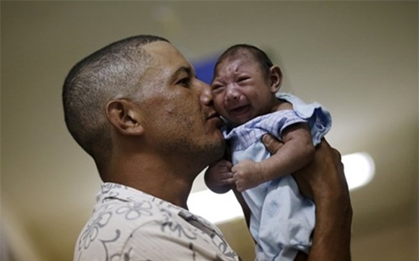 Chùm ảnh: Dịch bệnh Zika đầu nhỏ - nỗi khiếp sợ của toàn thế giới - Ảnh 29.