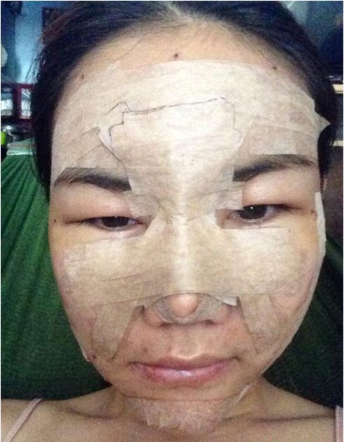 1001 cách sao Việt lộ ảnh băng bó khi phẫu thuật thẩm mỹ gây sốc - Ảnh 15.