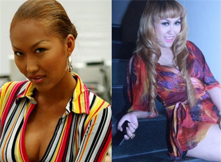 1001 cách sao Việt lộ ảnh băng bó khi phẫu thuật thẩm mỹ gây sốc - Ảnh 5.