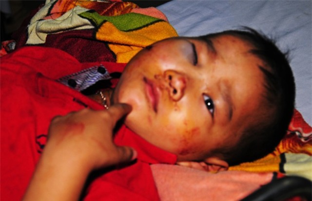 Nạn nhân xe khách lao xuống vực: 'Chúng tôi tưởng chết rồi'