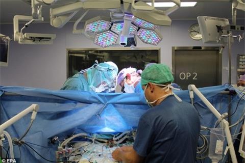 ky tich: tach roi hai be gai dinh lien than nho nhat the gioi hinh anh 2