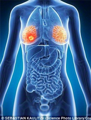 nguoi cao de mac ung thu hon hinh anh 1