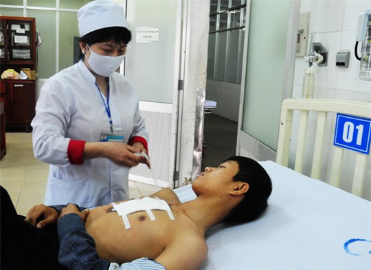 Một nạn nhân bị bỏng ở ngực do sự cố pháo hoa đêm giao thừa ở Quảng Ngãi. Ảnh: M.T
