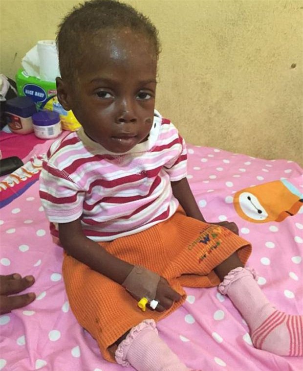 bi cho la phu thuy, be trai 2 tuoi bi bo me vut bo hinh anh 3