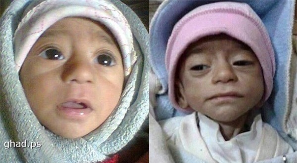 Đau lòng trước hình ảnh những đứa trẻ bị IS bỏ đói đến chết tại Syria - Ảnh 2.