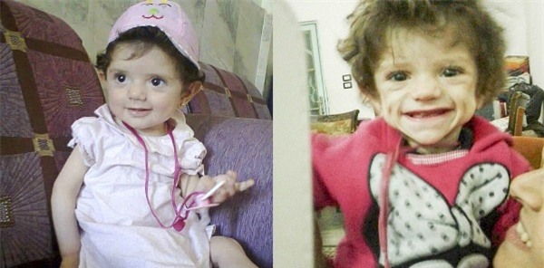 Đau lòng trước hình ảnh những đứa trẻ bị IS bỏ đói đến chết tại Syria - Ảnh 3.