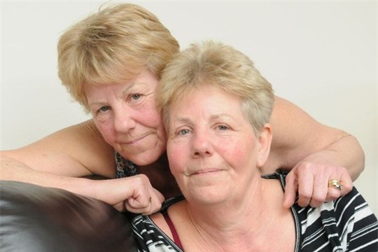 Cặp song sinh hiện đã 61 tuổi. Ảnh: SWNS