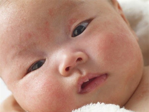 cham-sua-blogtamsuvn (2)