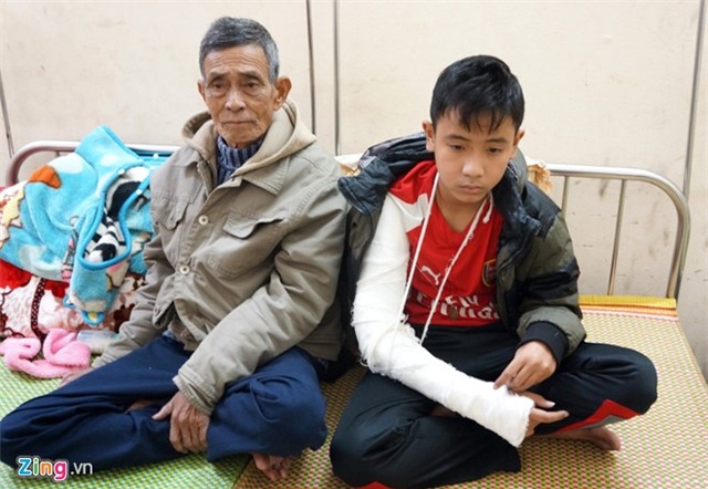 Nam sinh lớp 8 tố bị thầy giáo đánh phải bó bột