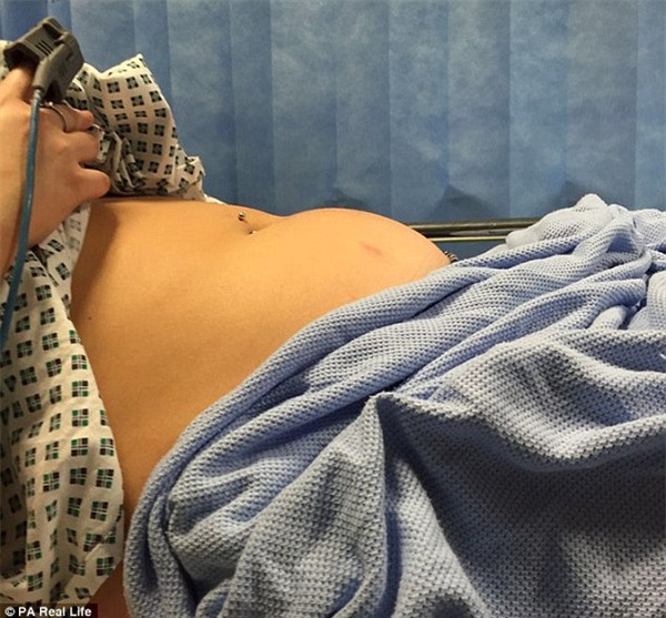 Anh: Nữ sinh suýt chết vì bỏ quên băng vệ sinh trong cơ thể suốt 9 ngày - Ảnh 2.