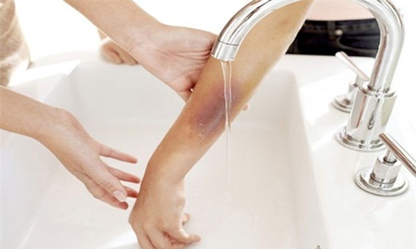 tai-nan-bong-blogtamsuvn