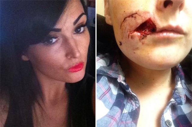 say ruou, mot phu nu can dut ma ban nhau hinh anh 1