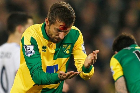 "Hôn" nhau trên không, cầu thủ Norwich kẻ vỡ đầu người gãy răng!