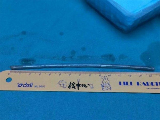 tq: buc vo, chong nuot chung dinh dai 15cm hinh anh 1