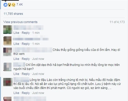 Đắp lông gà lên lưng để chữa bệnh đậu lào là phản khoa học - Ảnh 2.