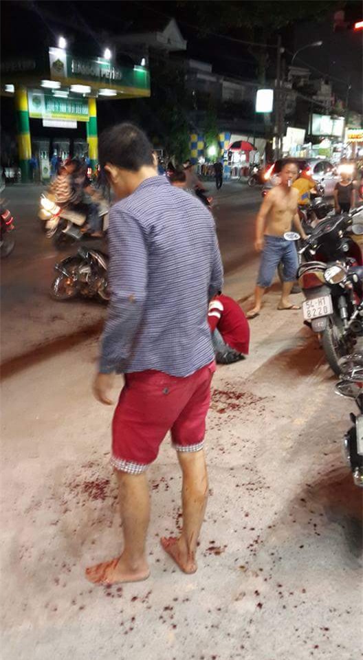 đâm chém, gò vấp, đứt lìa cánh tay, thanh niên, mâu thuẫn