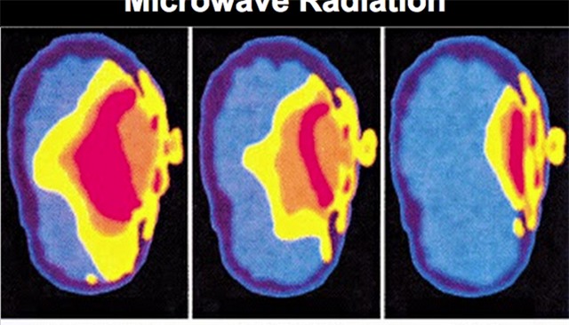 Điện thoại di động có thể gây ung thư não, vô sinh