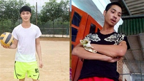 Vũ trước và sau tai nạn