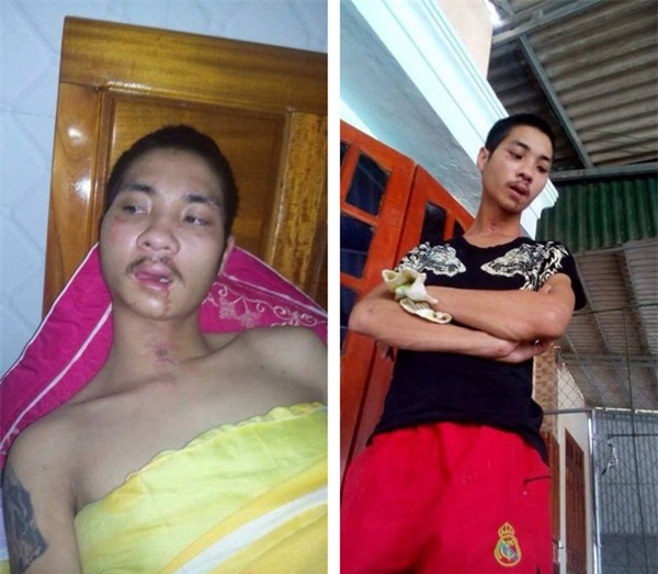 Phép màu đã đến! Người cha già vừa tìm được cậu con trai mất trí nhớ sau 2 ngày lạc con ở Hà Nội! - Ảnh 3.