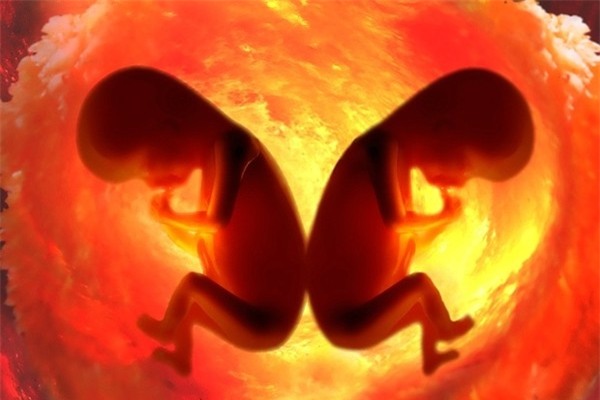 Những ca sinh đôi, sinh ba