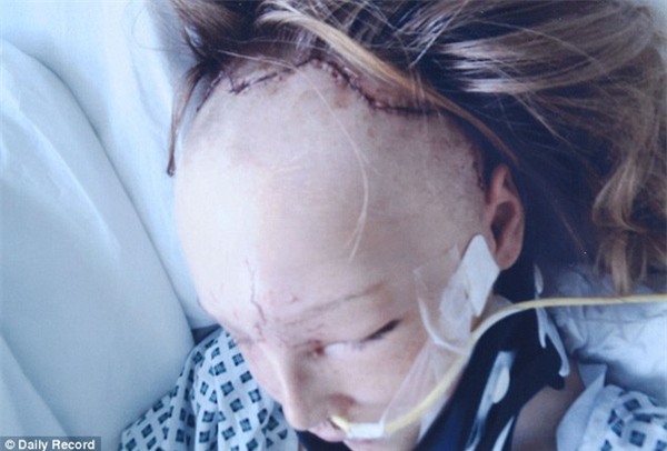Sống sót sau tai nạn, cô gái phải cắt bỏ hoàn toàn khuôn mặt để tái tạo diện mạo mới - Ảnh 3.