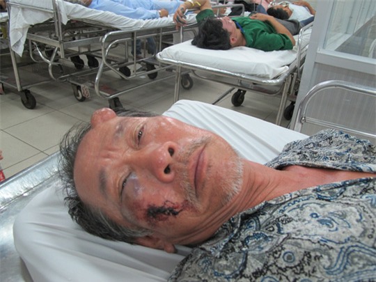 Người đàn ông tật nguyền bị đánh, cướp 40 tờ vé số - Ảnh 2.