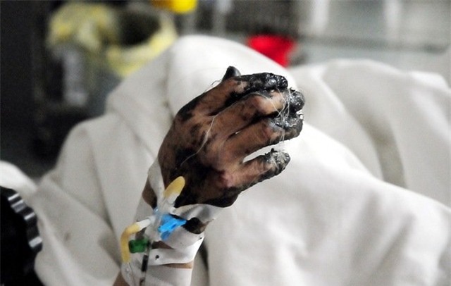 tai nạn giao thông, Hòa Bình, xe bồn đâm xe khách