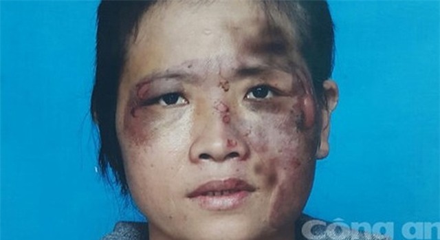 Vợ tố bị chồng tra tấn như thời trung cổ