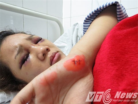 Chị Nguyễn Thị Phương Thảo đang phải điều trị tại Bệnh viện Hữu nghị Việt Tiệp Hải Phòng với nhiều thương tích - Ảnh MK
