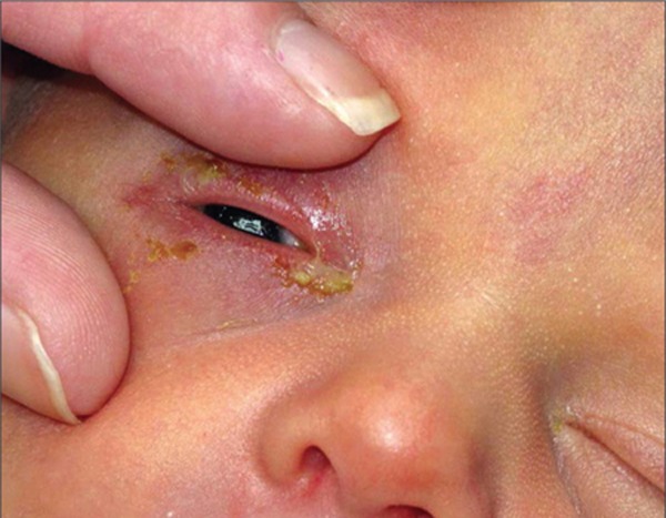 nho-mat-cho-tre-so-sinh-blogtamsuvn (2)