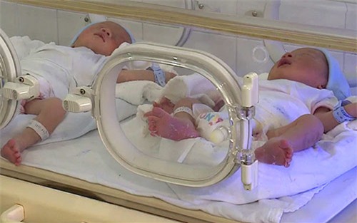 tam su cua thai phu mang thai ho cap song sinh dau tien - 1