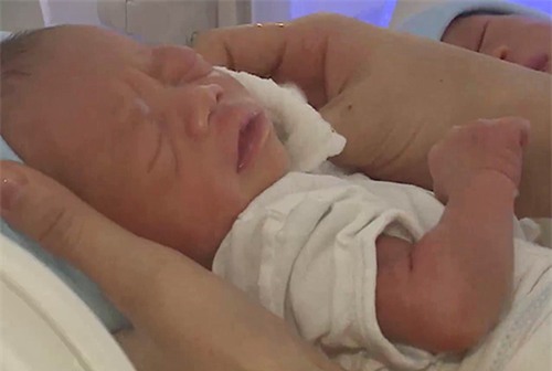 tam su cua thai phu mang thai ho cap song sinh dau tien - 2