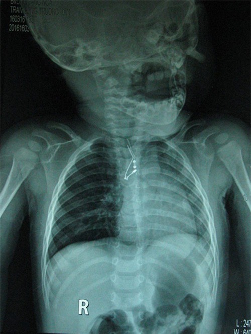 Đừng đánh đổi tính mạng của con vì bất cẩn - 1