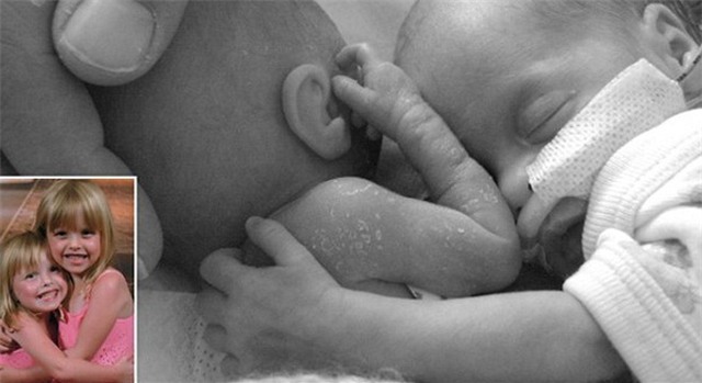 Kỳ lạ cô bé sinh ra chỉ dài bằng chiếc bút bi