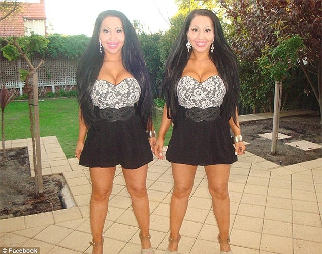 Hai chị em sinh đôi luôn muốn mọi thứ giống hệt nhau