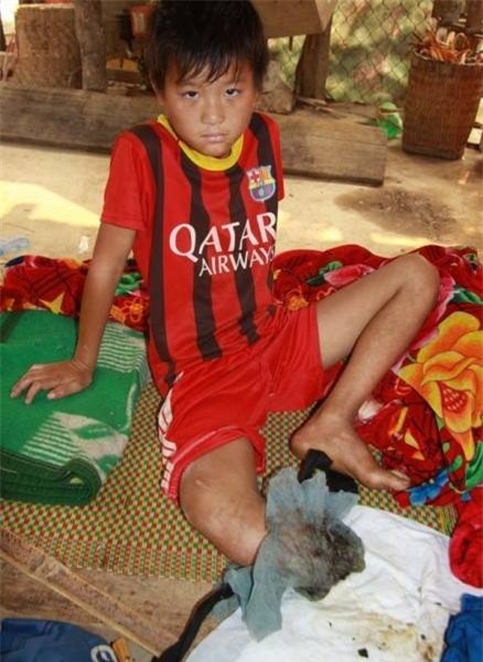 Cậu bé