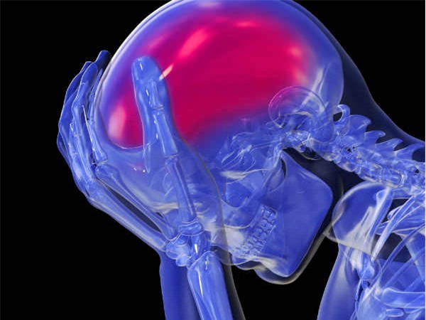 đau đầu dai dẳng