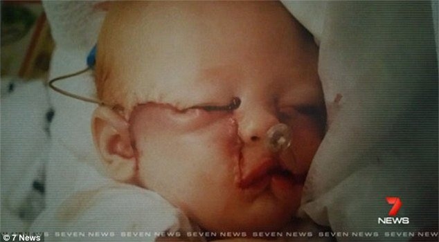 be gai thieu mot phan mat tro nen xinh dep nho phau thuat hinh anh 1