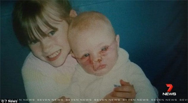 be gai thieu mot phan mat tro nen xinh dep nho phau thuat hinh anh 2