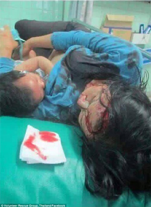 me bi thuong mau chay dam dia van cho con bu tren giuong benh - 1