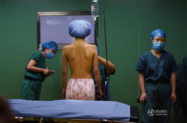 phẫu thuật nâng ngực