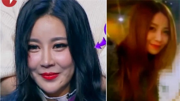 phẫu thuật thẩm mỹ