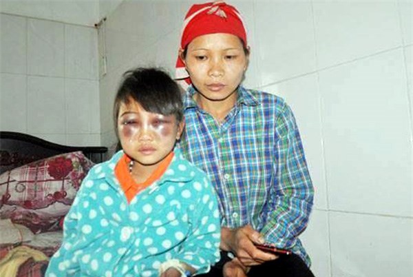 Vụ cô giáo đánh HS tím mặt: 
