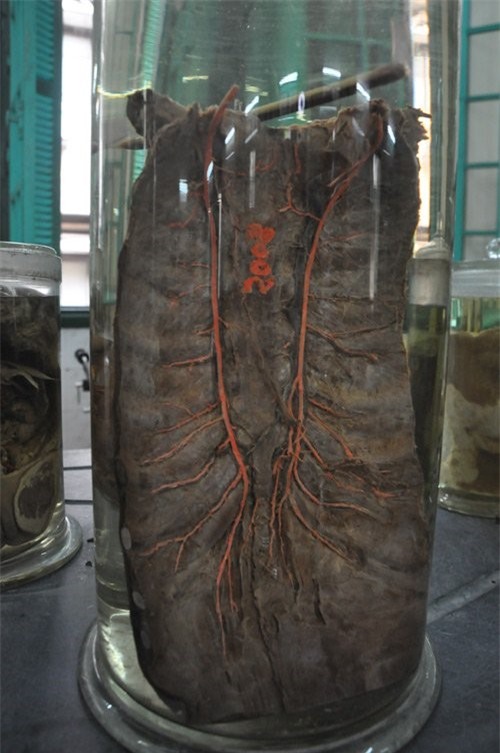 Can canh phong xac cua Dai hoc Y Ha Noi hinh anh 6