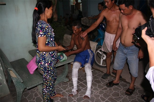 Binh gas chay du doi, nu cong nhan bi bong nang hinh anh 1